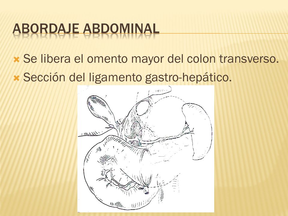 La causa del dolor la parte inferior de la espalda